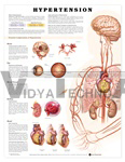 Hypertension Anatomical Chart